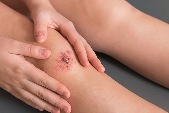 Schaafwond? Een kusje erop helpt niet altijd, lees daarom deze tips!